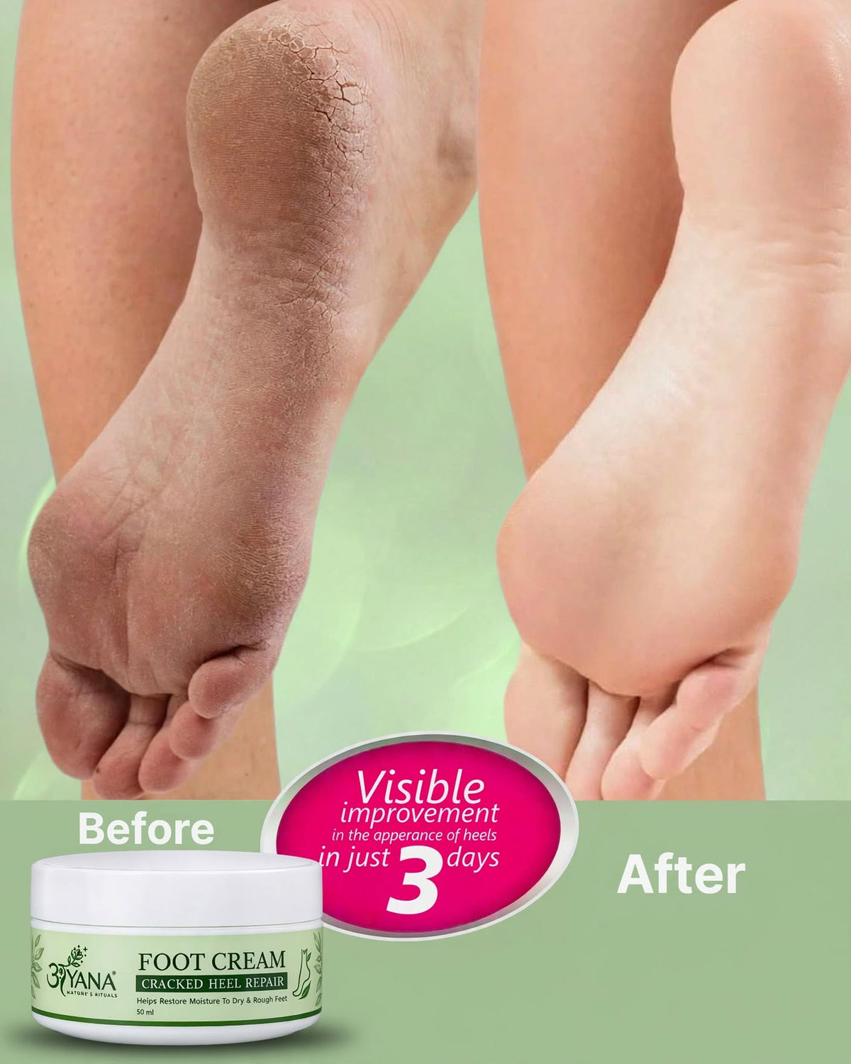AYANA Foot Cream for Cracked Heels β Moisturizing Cream for Dry, Rough Feet | 50 ml