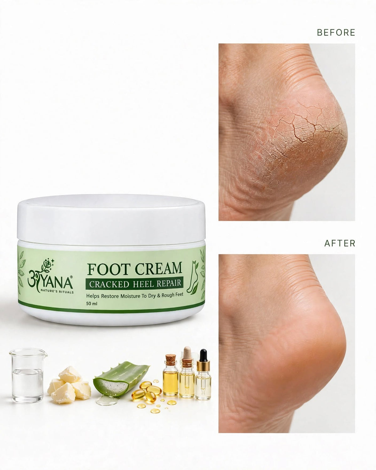 AYANA Foot Cream for Cracked Heels β Moisturizing Cream for Dry, Rough Feet | 50 ml